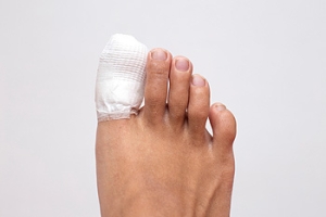 Reasons for a Fractured Toe