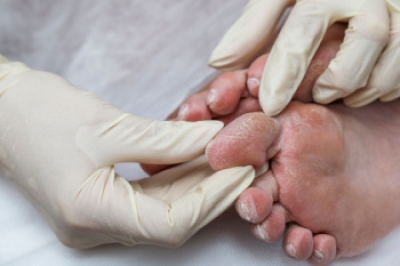 What a Diabetic Foot Exam Can Uncover