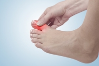 Managing Flare-Ups of Gout