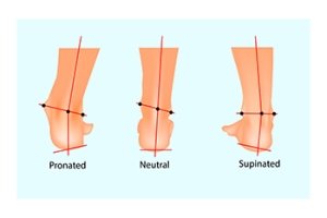 Understanding Types of Pronation